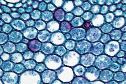 Pith Parenchyma in the Monocot Root: Smilax cross section: Smilax root common name: Greenbriar magnification- unsplash